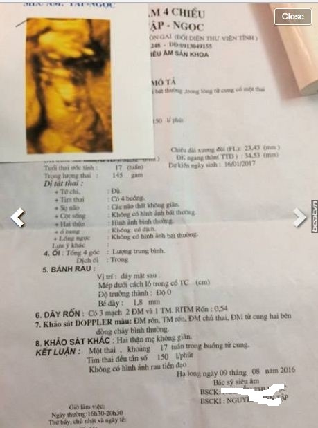tam su dam nuoc mat cua co gai phat hien ban than co thai voi nguoi yeu cua minh