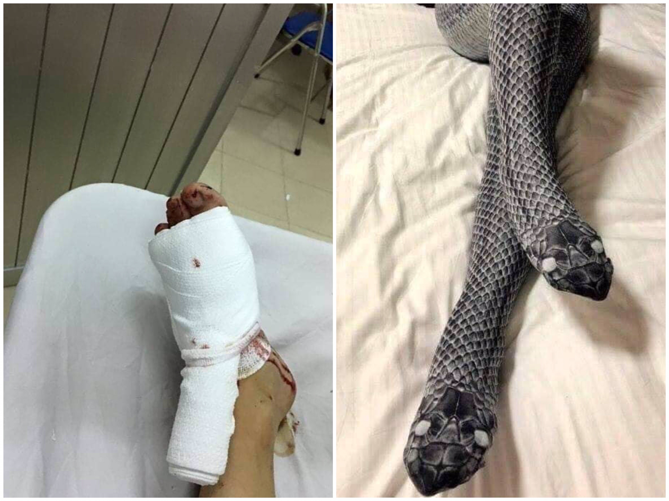 Xôn xao câu chuyện đầy bi hài của cô gái trẻ đi tất hình da rắn để quyến rũ chồng xon xao cau chuyen day bi hai cua co gai tre di tat hinh da ran de quyen ru chong