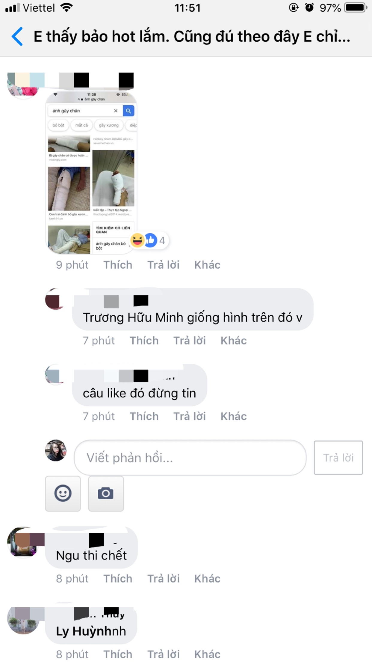 Xôn xao câu chuyện đầy bi hài của cô gái trẻ đi tất hình da rắn để quyến rũ chồng xon xao cau chuyen day bi hai cua co gai tre di tat hinh da ran de quyen ru chong