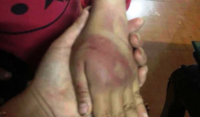 vu be gai bi bao hanh o thanh hoa be gai am anh vi bi danh nhieu lan