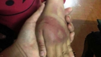 vu bo bao hanh con gai o thanh hoa gia dinh se gui don ra toa
