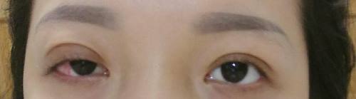 co gai vinh vien khong the nham mat sau khi cat mi lam dep