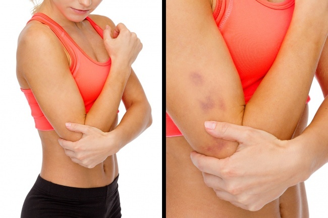 12 'tác dụng phụ' chúng ta phải đối mặt khi tập luyện 12 tac dung phu chung ta phai doi mat khi tap luyen