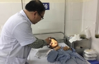 bac si soc khi phat hien 16 chiec kim khau trong nguoi be trai 11 thang tuoi