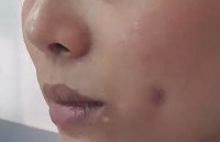 tim hieu ve silicone va lieu phap lam dep bang silicone