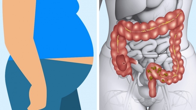 9 dấu hiệu cho thấy cơ thể bạn đang tiêu hóa thịt không đúng cách 9 dau hieu cho thay co the ban dang tieu hoa thit khong dung cach