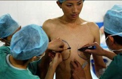 Chuyển giới - Tác động của phẫu thuật và hormon