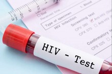Tại sao số ít người trưởng thành được xét nghiệm HIV?