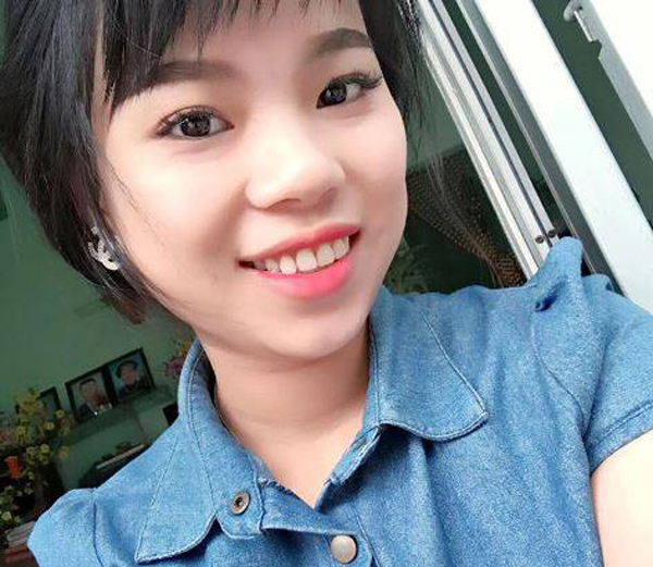 co gai bien dang mat do axit duoc ghep da de phuc hoi dien mao