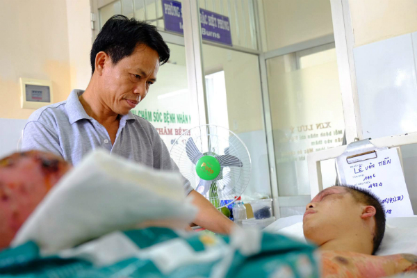 ong bo tinh nguyen hien da de ghep cho con trai bi bong nang