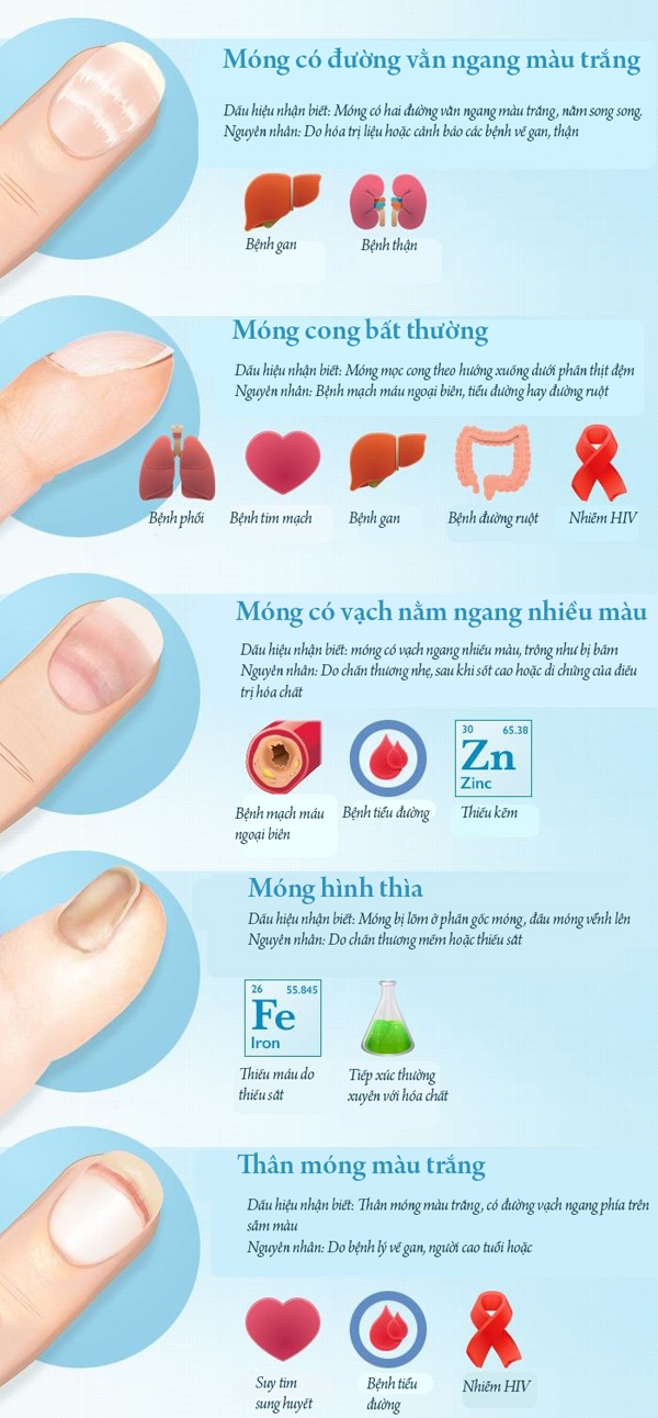 5 dau hieu khac thuong tren mong tay canh bao van de suc khoe