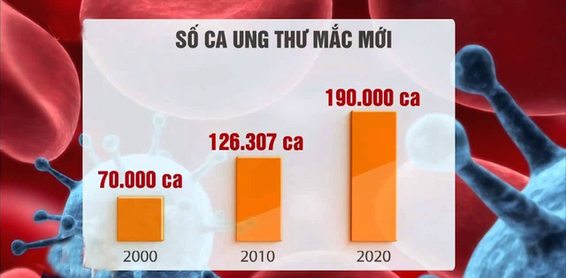 tai sao ung thu ngay mot gia tang