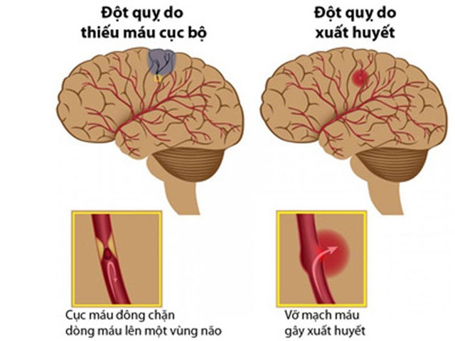 dot quy cuop di sinh mang 100000 nguoi viet mot nam
