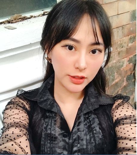 sau hang loat phot ve tiem filler dau la cuu canh cho phuong phap lam dep nay