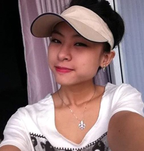 sau hang loat phot ve tiem filler dau la cuu canh cho phuong phap lam dep nay