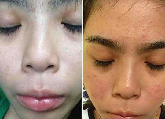 kem cot lam trang da than duoc hay thuoc doc