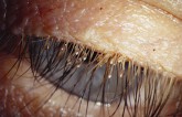 Chuyện khó tin: Đôi mắt rất dễ bị lây các bệnh lây nhiễm qua đường tình dục