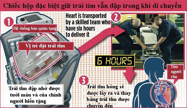 ky dieu trai tim hien tang van dap nhip trong suot qua trinh van chuyen