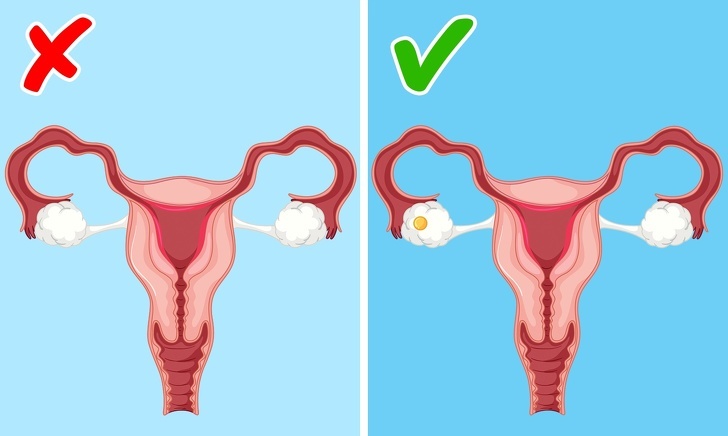 9 dấu hiệu trên cơ thể phụ nữ 'cảnh báo' các vấn đề sức khỏe 9 dau hieu canh bao suc khoe cua phu nu