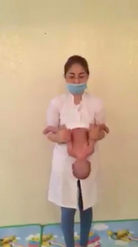 sung sot clip cam chan doc nguoc dau roi lac manh tre so sinh nhu bup be vi cho rang giup be tranh khuyet tat