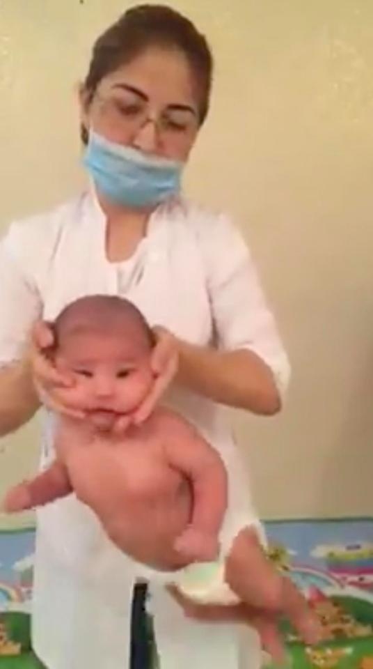 sung sot clip cam chan doc nguoc dau roi lac manh tre so sinh nhu bup be vi cho rang giup be tranh khuyet tat