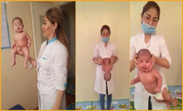 sung sot clip cam chan doc nguoc dau roi lac manh tre so sinh nhu bup be vi cho rang giup be tranh khuyet tat