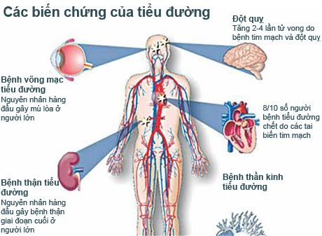 nhung dau hieu nhan biet benh ly dai thao duong type 1 type 2 va type 3