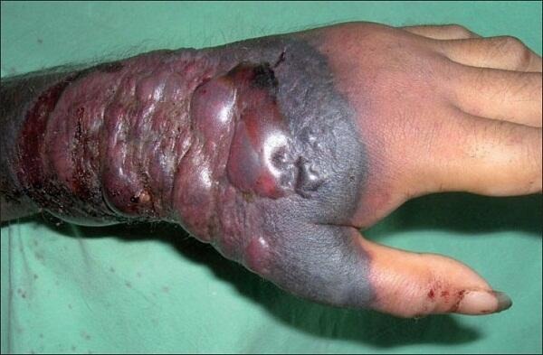 them 27 nguoi chet vi virus ebola viet nam giam sat chat cua khau ngan dich chet nguoi