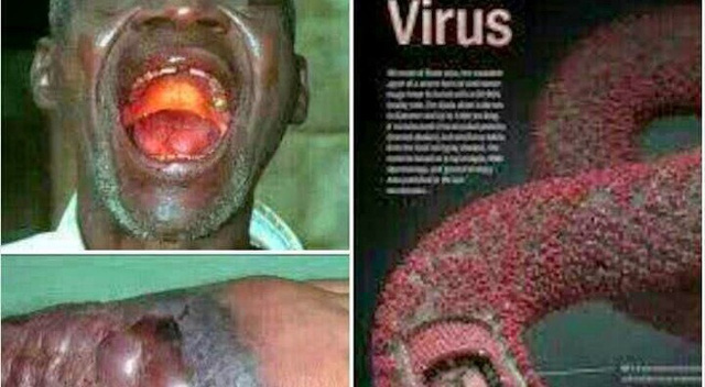 them 27 nguoi chet vi virus ebola viet nam giam sat chat cua khau ngan dich chet nguoi