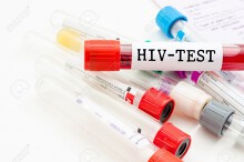 Test nước bọt phát hiện người nhiễm HIV trong cộng đồng