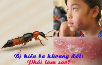 kien ba khoang tan cong cu dan quan 7 o sai gon