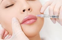 co gai mu mat khi tiem filler spa dinh nhieu sai pham