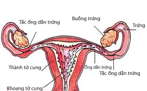 nhung benh ly o buong trung gay hiem muon