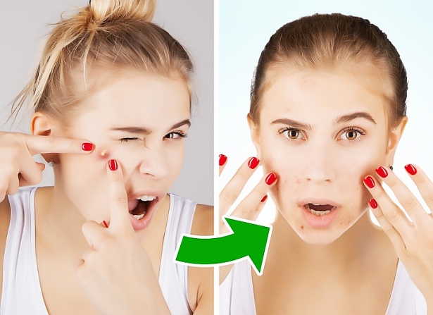 Một số bệnh về da có thể bạn chưa từng nghe mot so benh ve da co the ban chua tung nghe