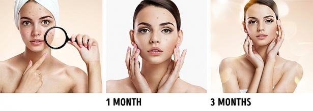 10 quy tắc chăm sóc da giúp phụ nữ Hàn Quốc luôn trẻ trung 10 quy tac cham soc da giup phu nu han quoc luon tre trung