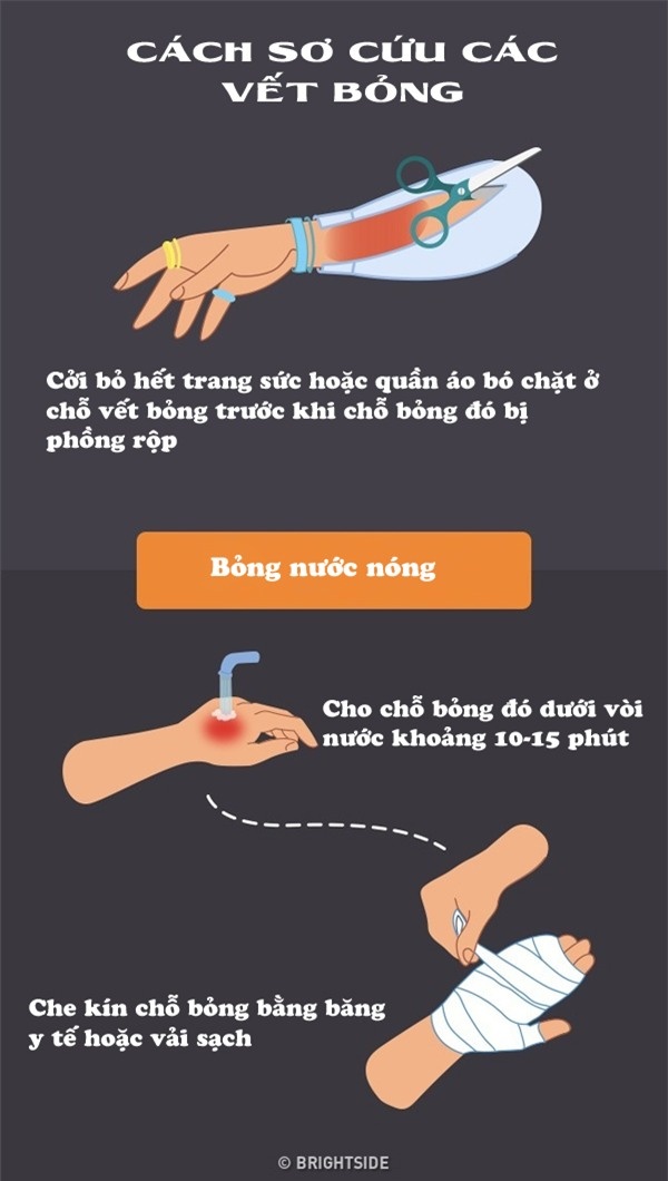 cach so cuu mot so truong hop khan cap moi nguoi phai biet de khong mat mang