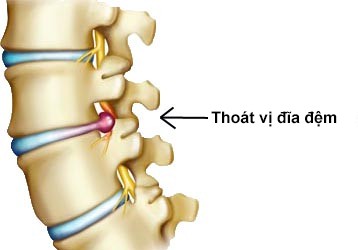 thoai hoa cot song sau 40 nam nam vong
