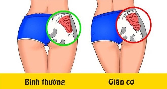 Hội chứng mông chết do ngồi quá nhiều, bạn đã nghe bao giờ chưa? hoi chung mong chet do ngoi qua nhieu ban da nghe bao gio chua