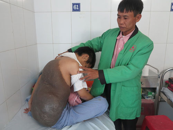 chang trai cong mai rua khong lo 26 nam ngu ngoi