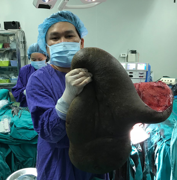 chang trai cong mai rua khong lo 26 nam ngu ngoi