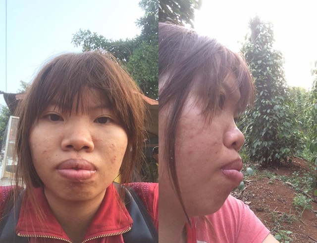 diem danh 2 co gai khien chi em chia se ran ran sau hanh trinh lot xac