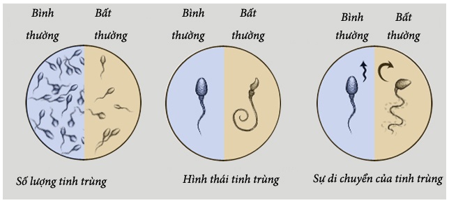 gian tinh mach tinh can benh gay vo sinh nam gioi can de phong