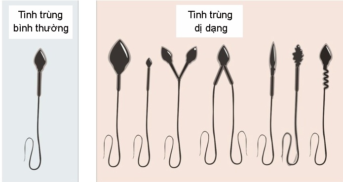 moi truong song bi o nhiem co the khien tinh trung bien dang