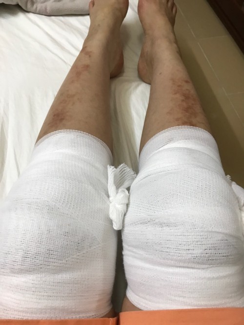 clip danh ca thanh tuyen tiet lo bi tai nan khi di dien xin loi khan gia vi vang mat o liveshow quang le