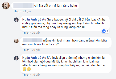 lo bang chung le au ngan anh moi di lam rang de nang cap sac dep