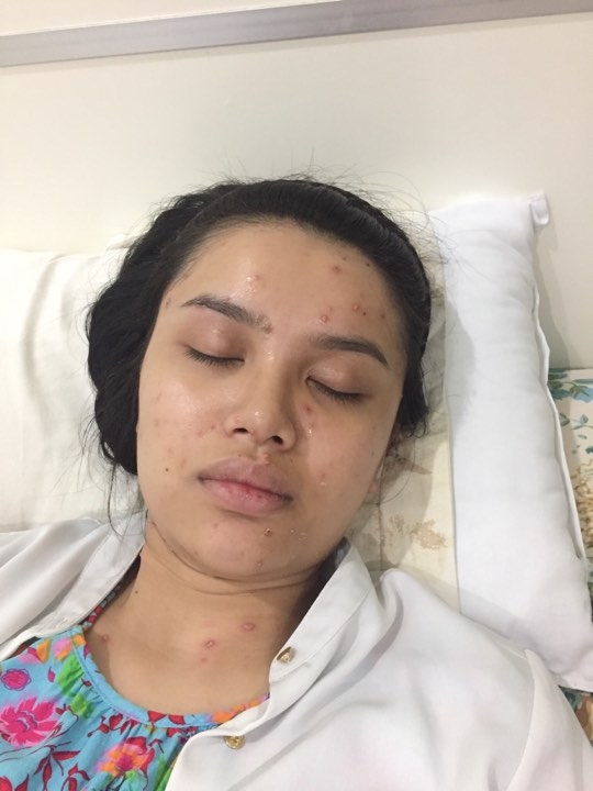 loat sao viet tung phai khon don huy show nhap vien vi benh thuy dau