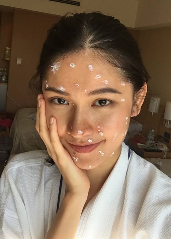 loat sao viet tung phai khon don huy show nhap vien vi benh thuy dau