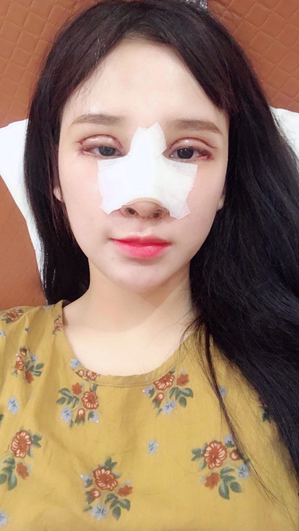 yen tatoo va hanh trinh thay doi nhan sac sau phau thuat tham my