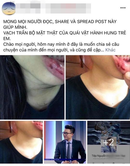 btv minh tiep noi gi truoc thong tin bao hanh em vo