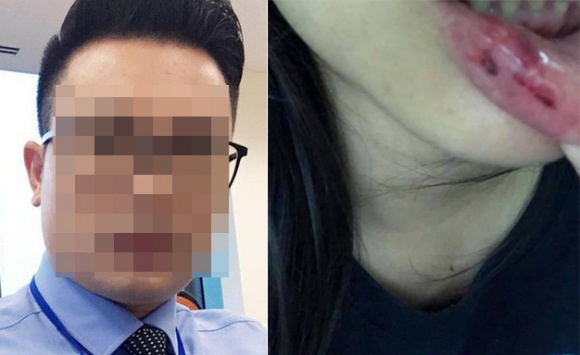 vu btv minh tiep bi nghi bao hanh em vo bo cua nu sinh 15 tuoi len tieng